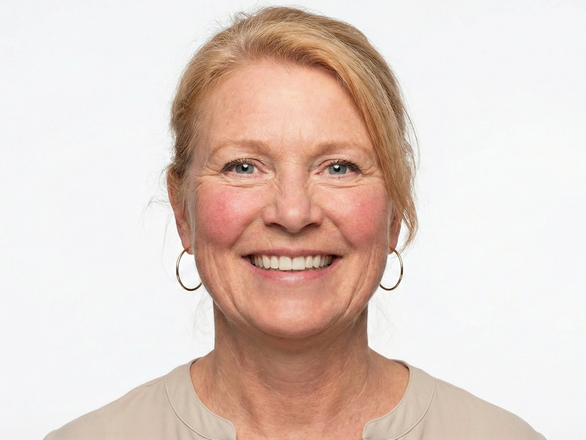 Patient smile after dental simulation preview