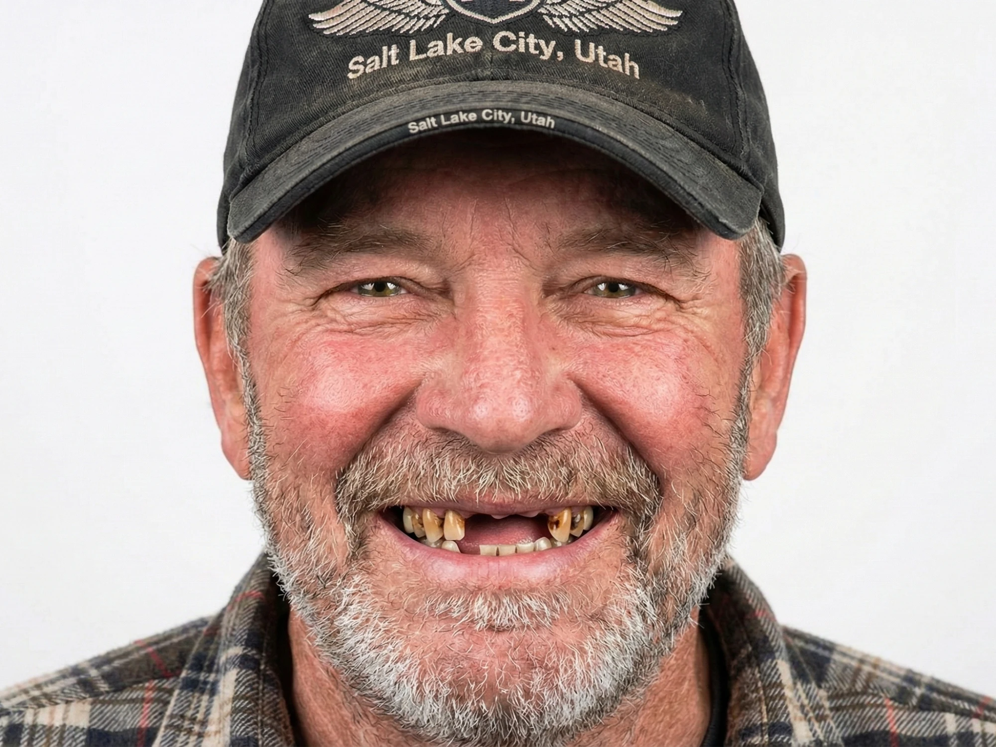 Patient smile before dental simulation