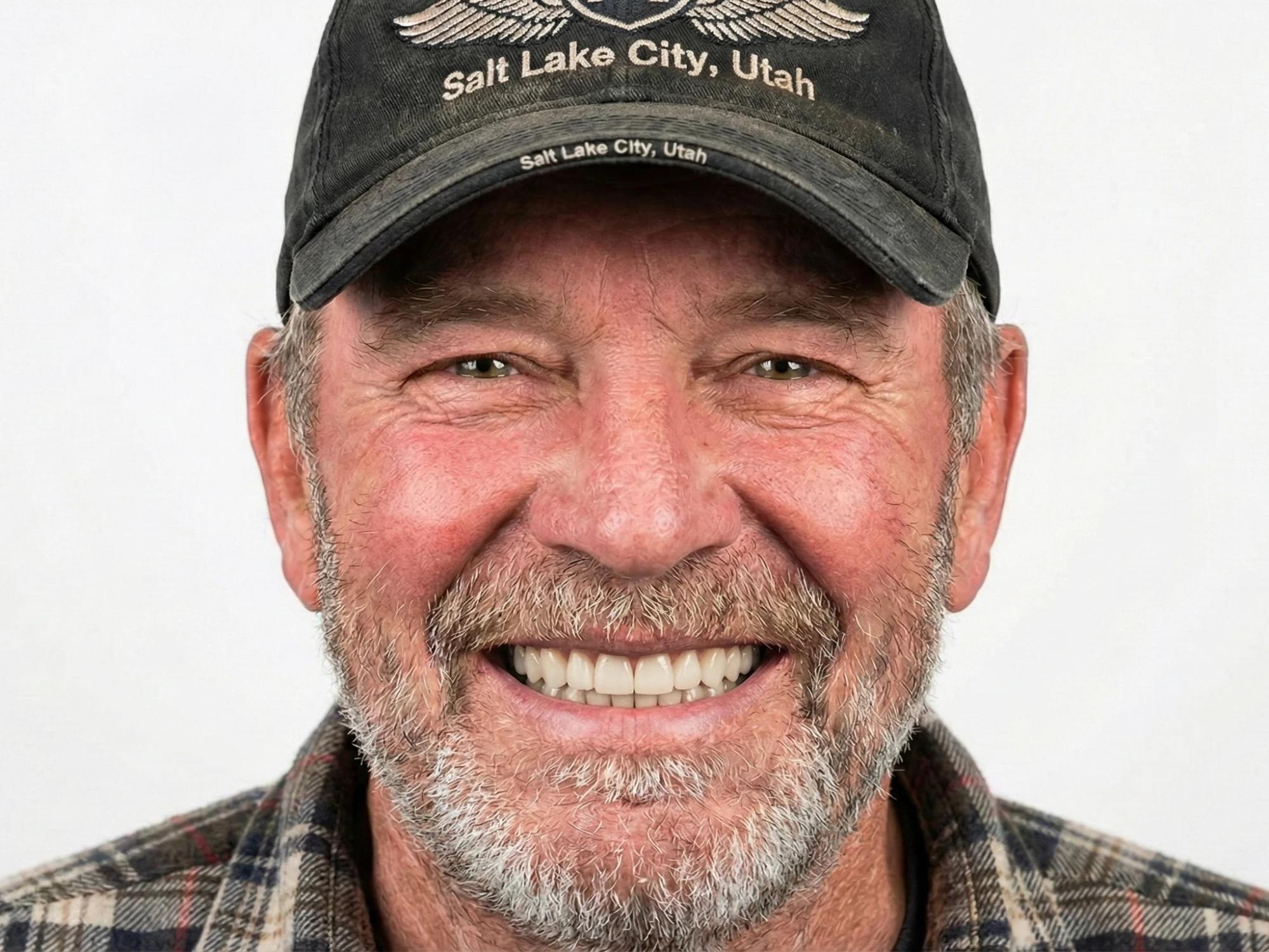 Patient smile after dental simulation preview